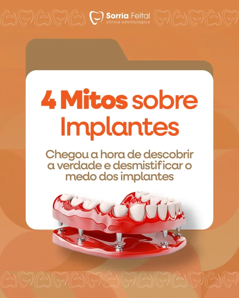 Post: 4 mitos sobre implantes